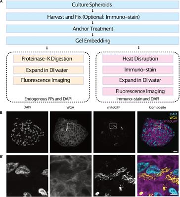 High-Resolution Imaging of Tumor Spheroids and Organoids Enabled by Expansion Microscopy